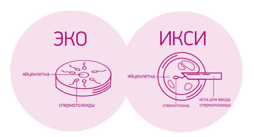 Эко 4s. Эко. Виды эко. См эко. Описание Реутик эко фото и описание.